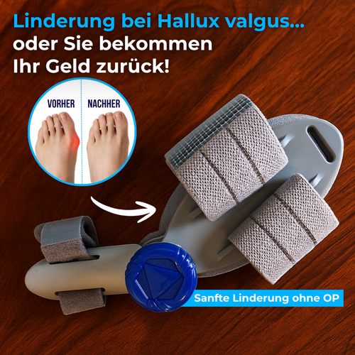 BuniFix™ Hallux Valgus Korrektur